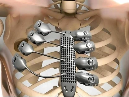 Titanium dental implants Titanium dental implants